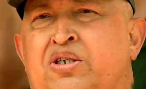 Chavez enfermo