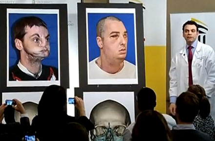 Cirugia de cara