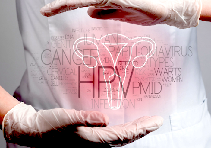 Cómo prevenir el cáncer de cuello uterino